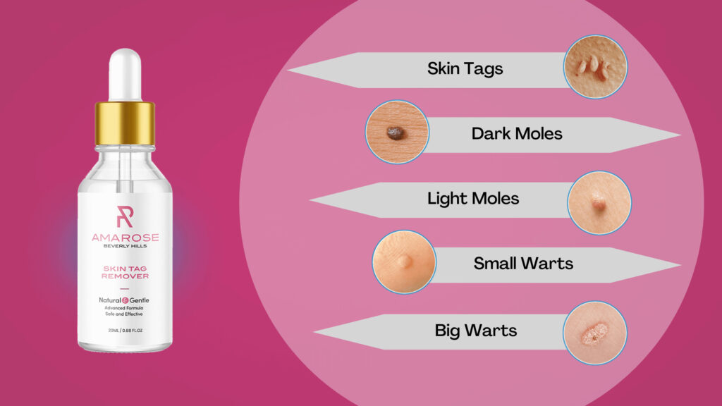Amarose Skin Tag Remover Serum