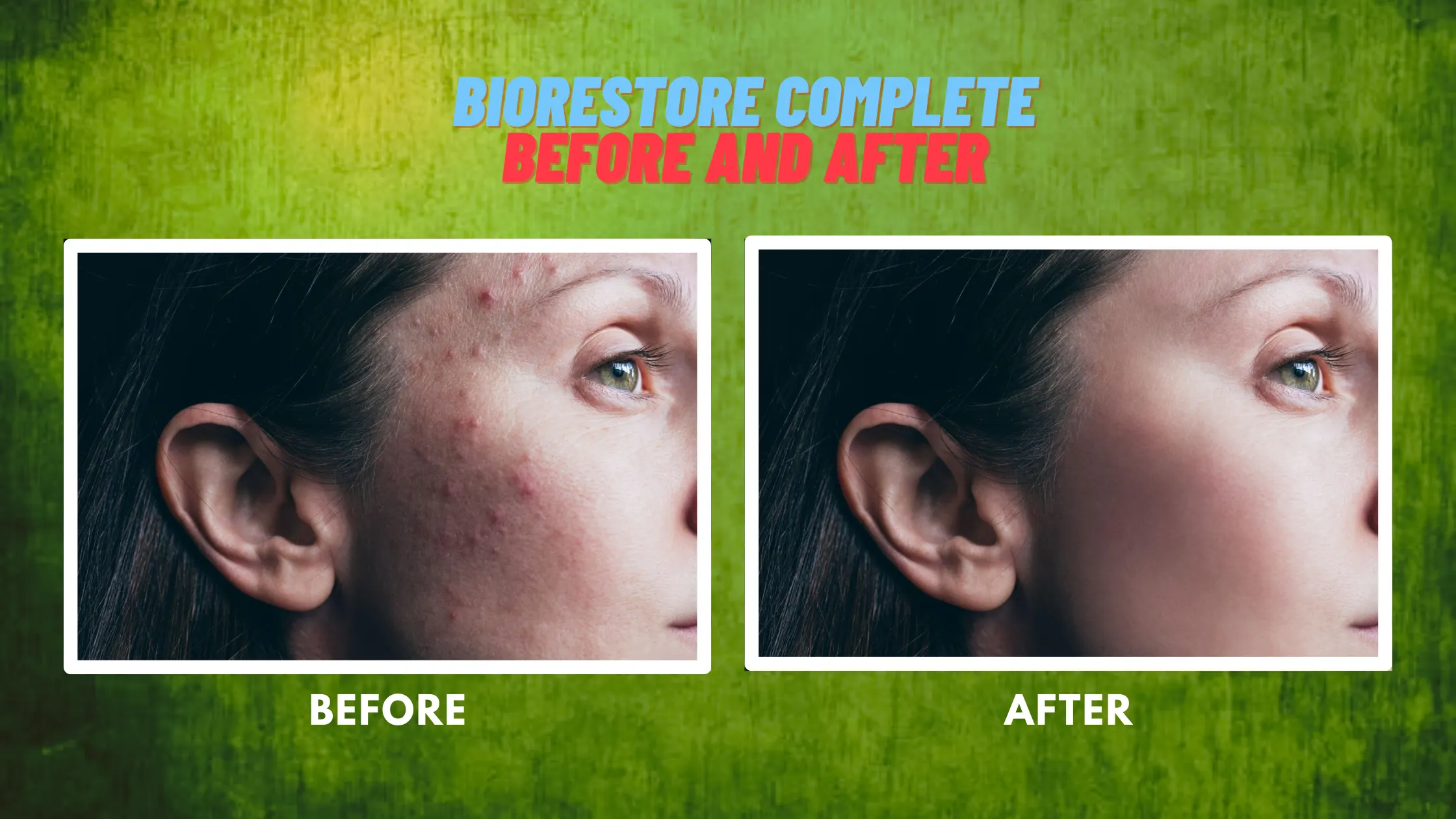 BioRestore Complete before and after