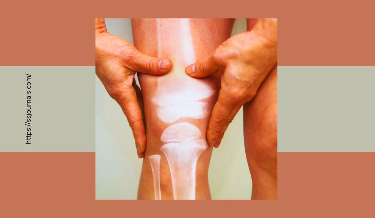 Overcoming Bone Spurs Tips For Improving The Quality Of Life