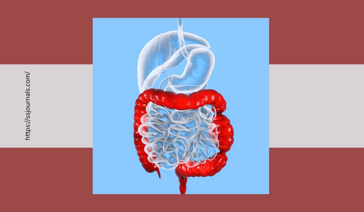 Can Colonoscopy Detect Irritable Bowel Syndrome Unveiling The Truth