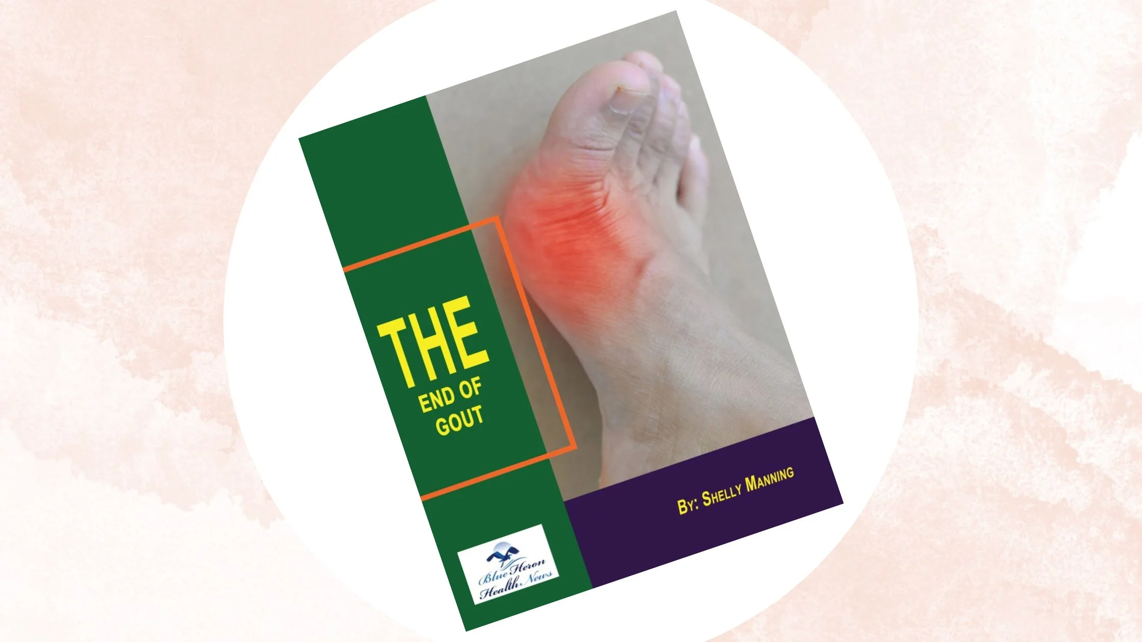 End Of Gout Review