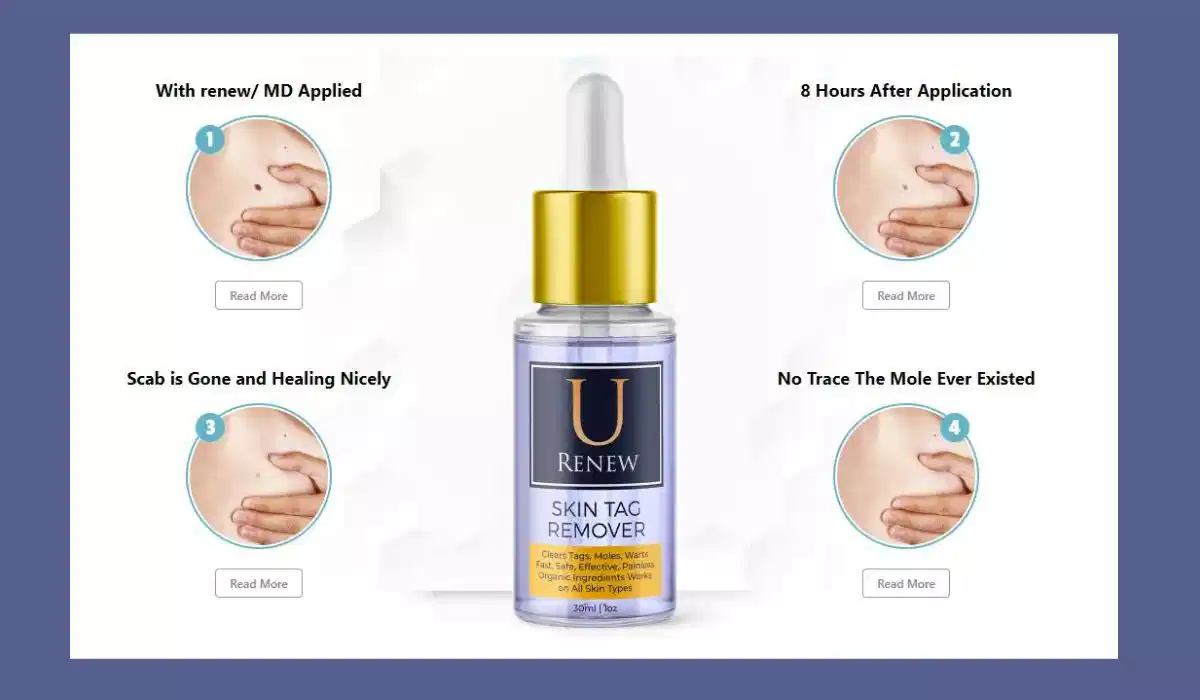 U Renew Skin Tag Remover Solution