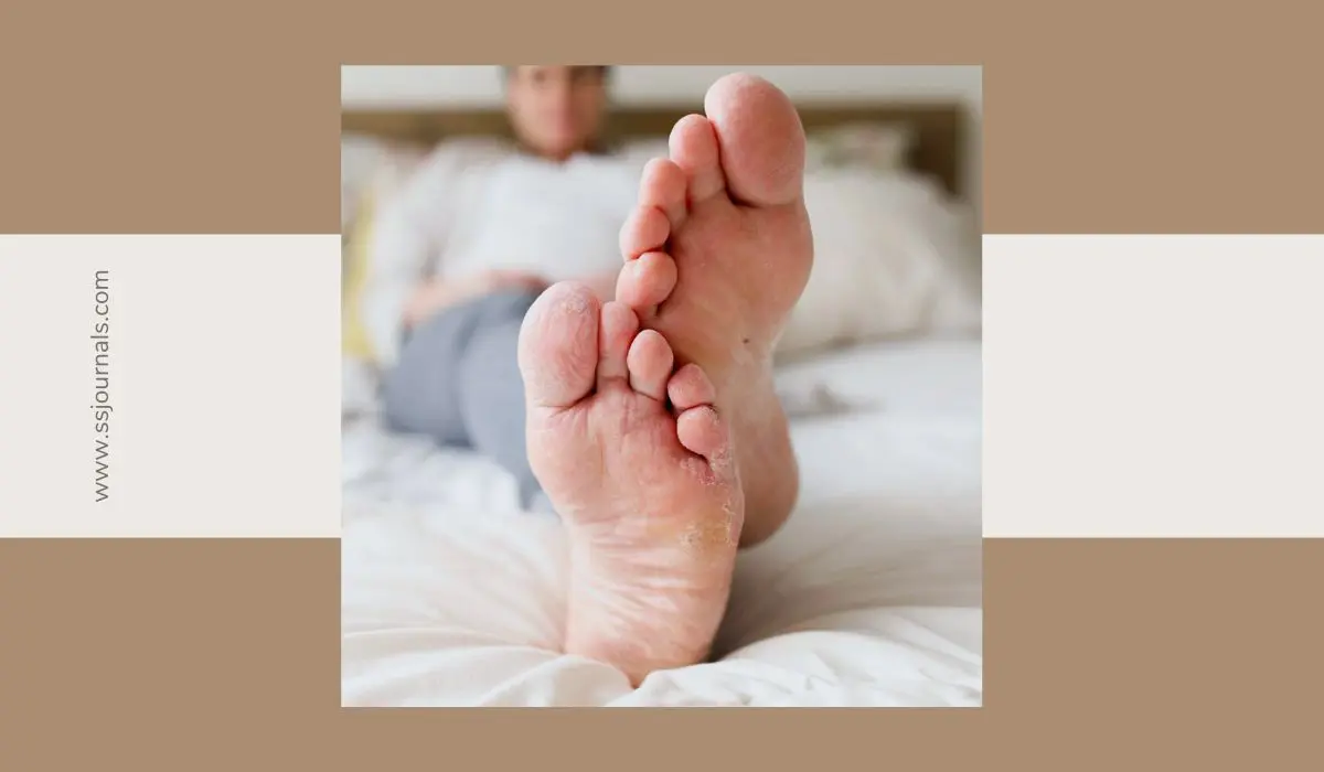 What Is The Cause Of Foot Fungus? Root Causes Explained