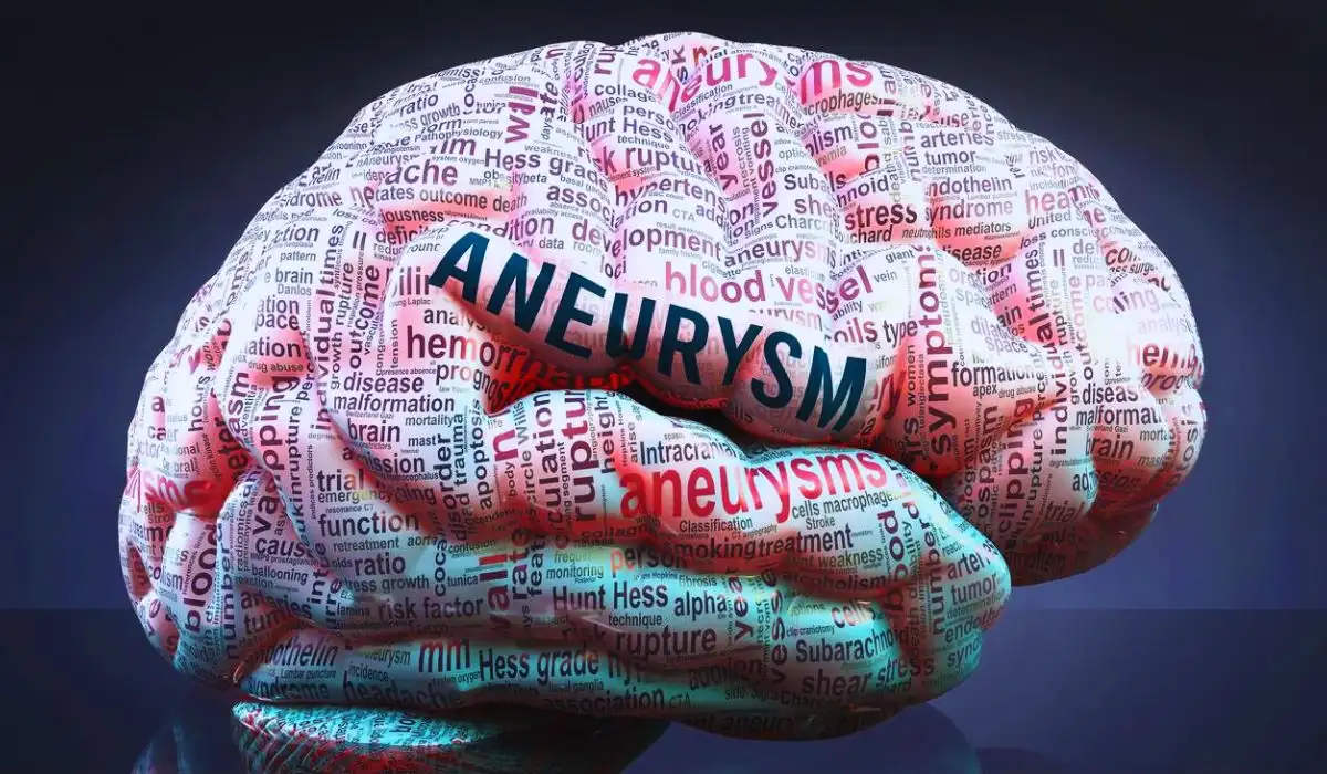 Brain Aneurysm