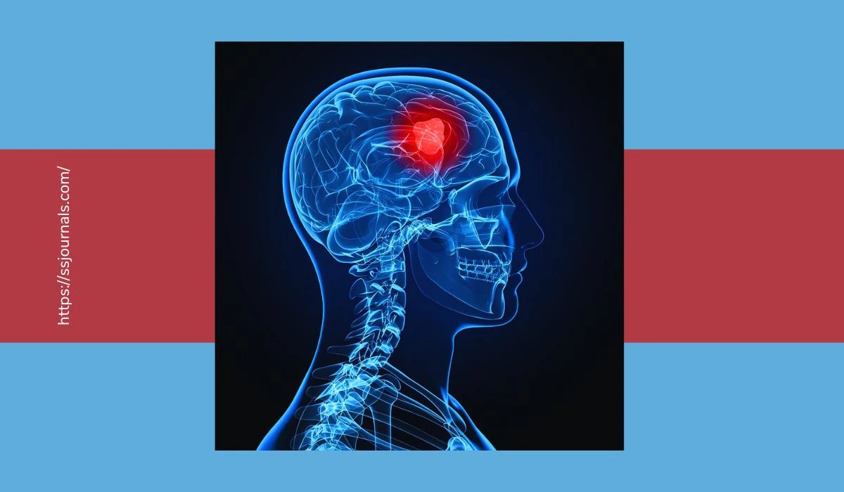 Can Brain Tumor Be Cured By Medicines Causes, And, Treatments