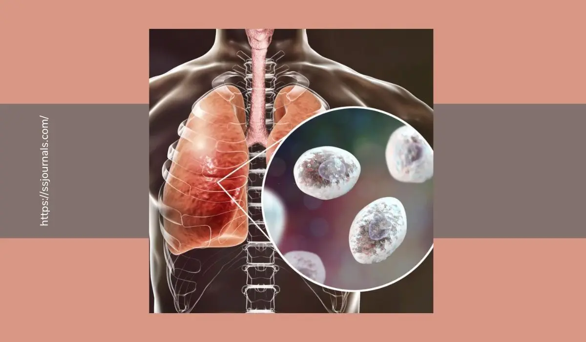 Lung Tumor & Nodules