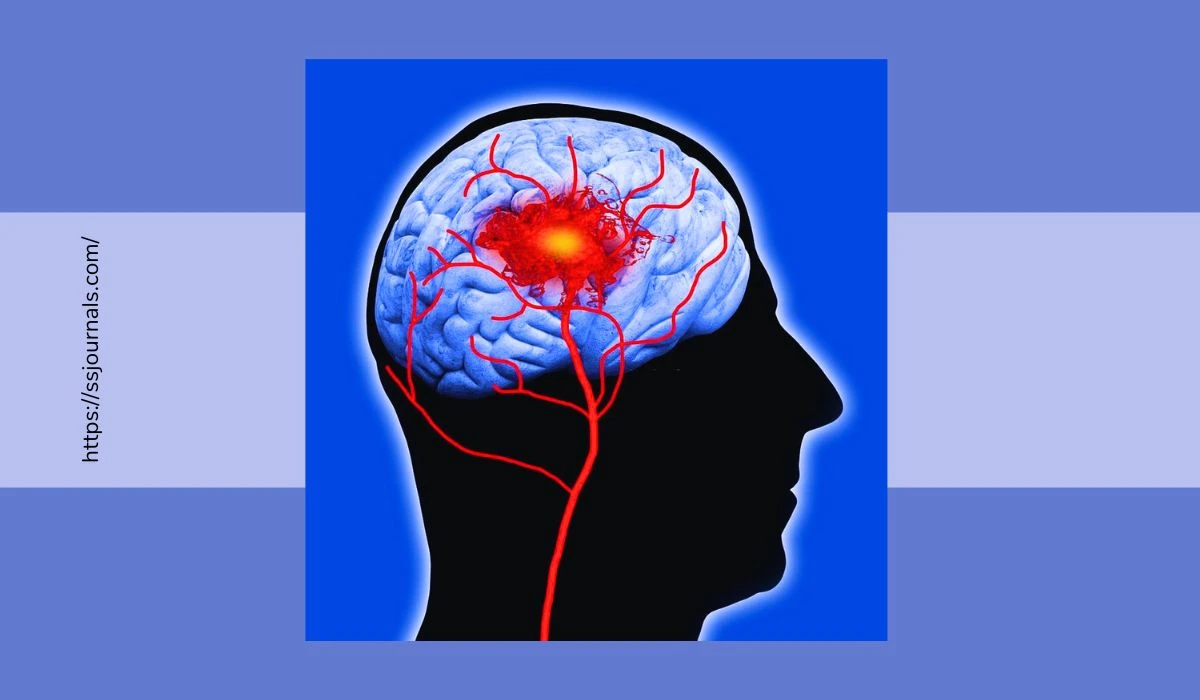 What Are The Common Brain Hemorrhage Symptoms Causes, And Treatments