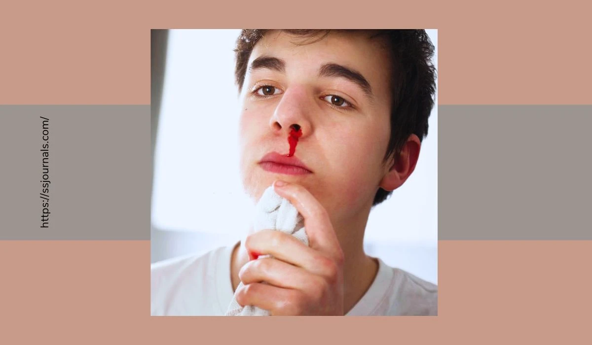 What Causes Nosebleeds With Large Blood Clots Beyond The Tissue