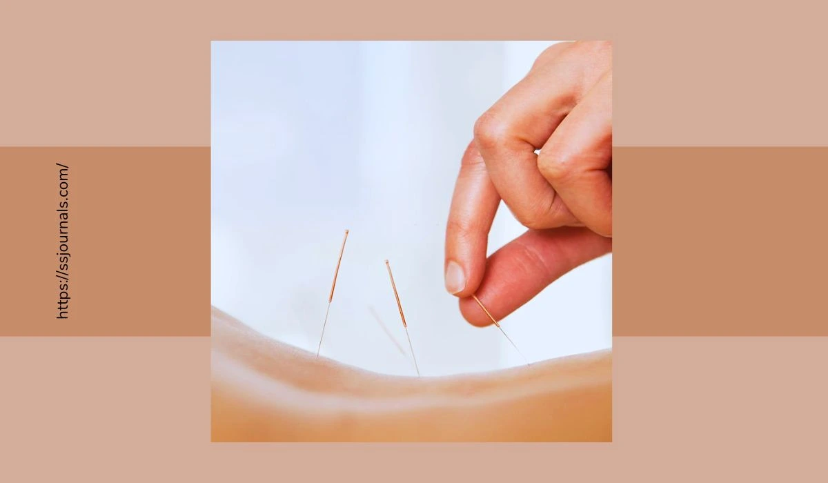 Can Acupuncture Help With Weight Loss Pin-Pointing The Pounds