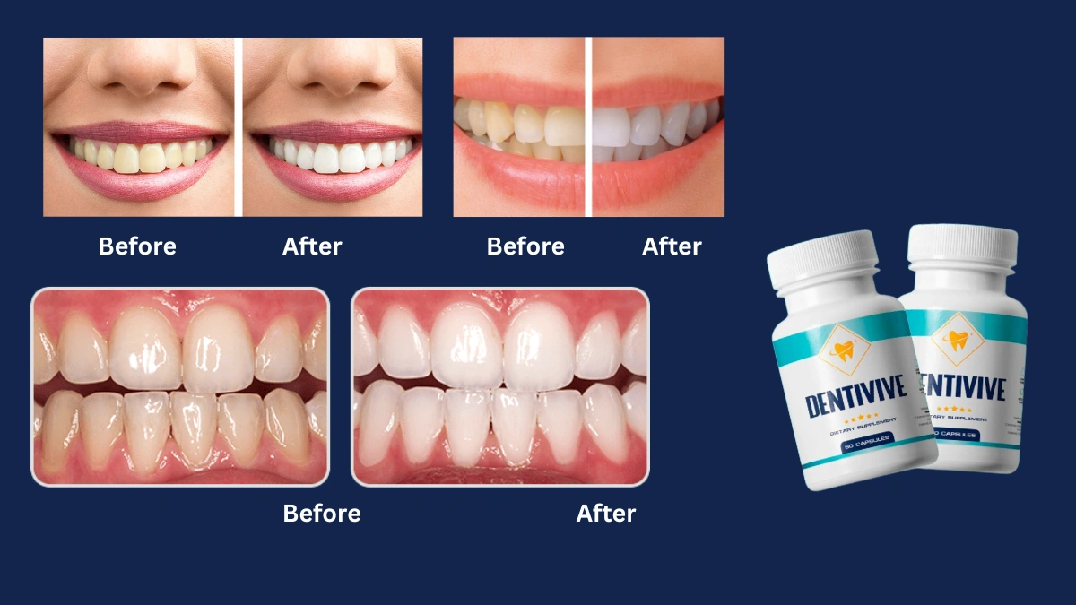 DentiVive Before and After