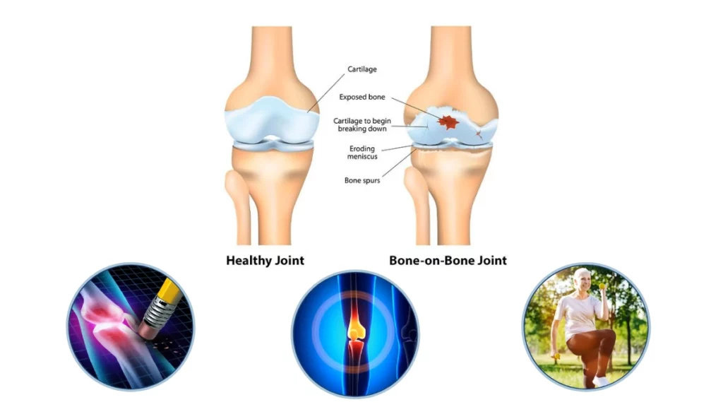 Flexafen Joint wellness formula