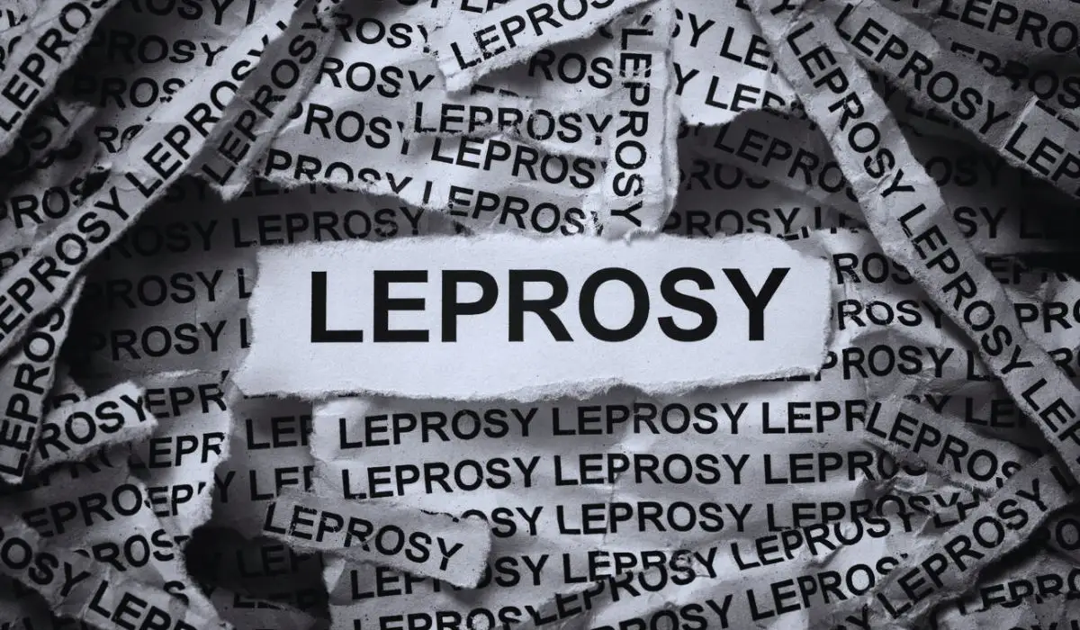 Symptoms Of Leprosy