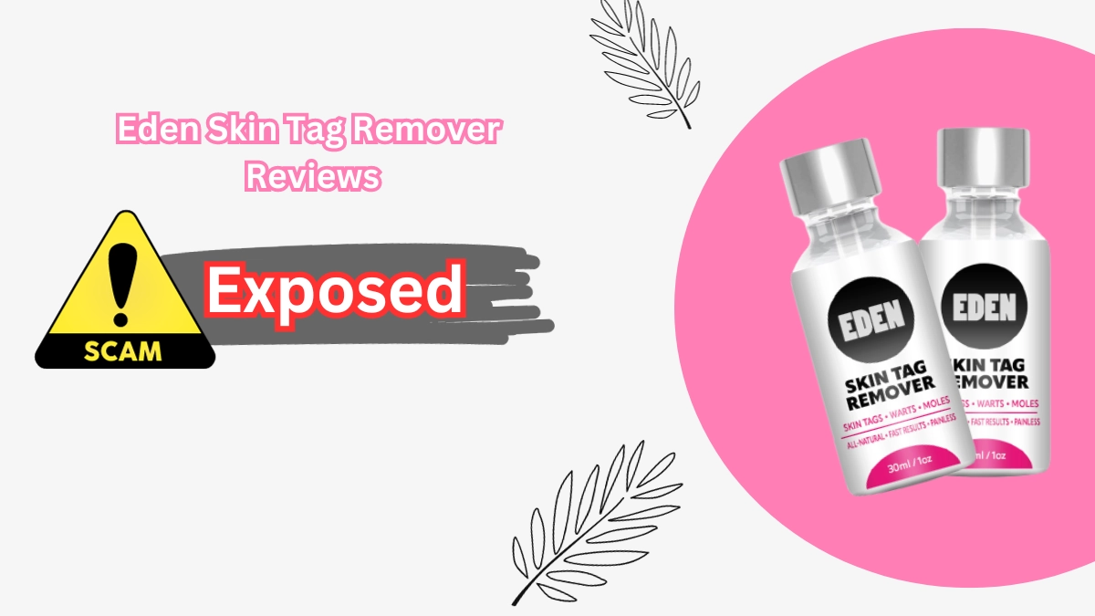 Eden Skin Tag Remover Bewertungen