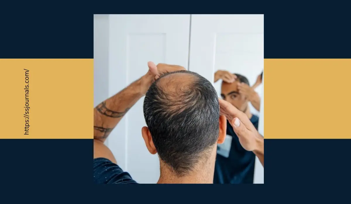 How to prevent hair loss while taking testosterone