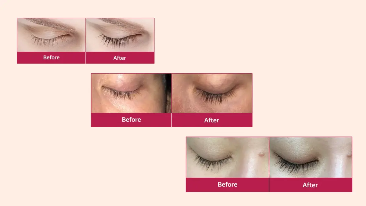Miracle Lash before and after