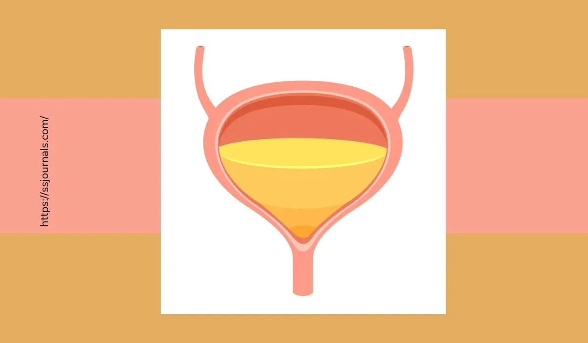 Urobilinogen High In Urine