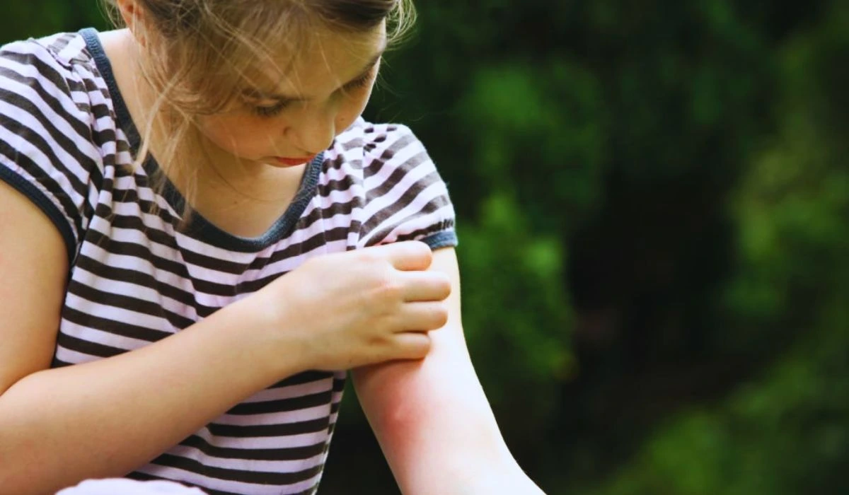 West Nile Virus Symptoms In Children