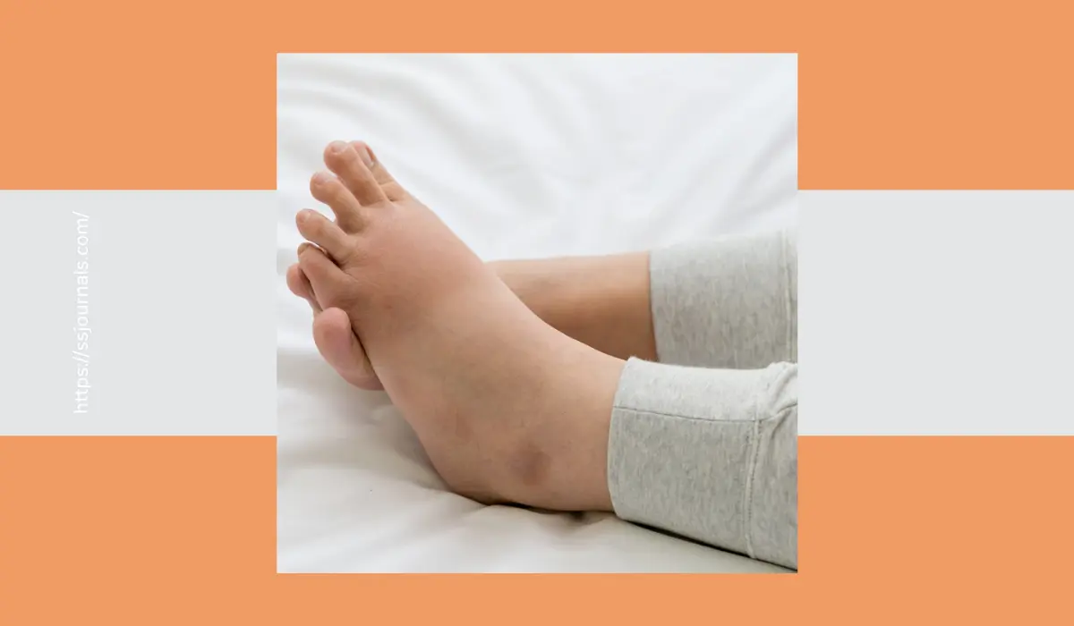 Foods That Cause Swelling in Feet