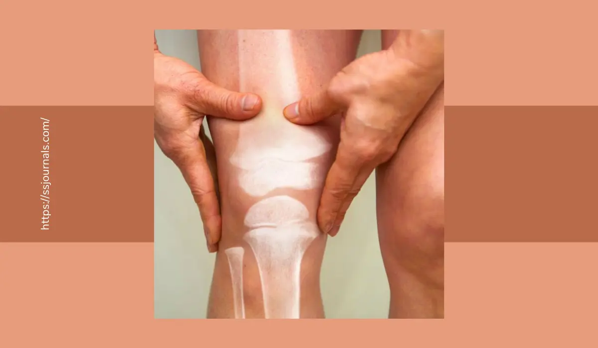 Osteoarthritis Causes