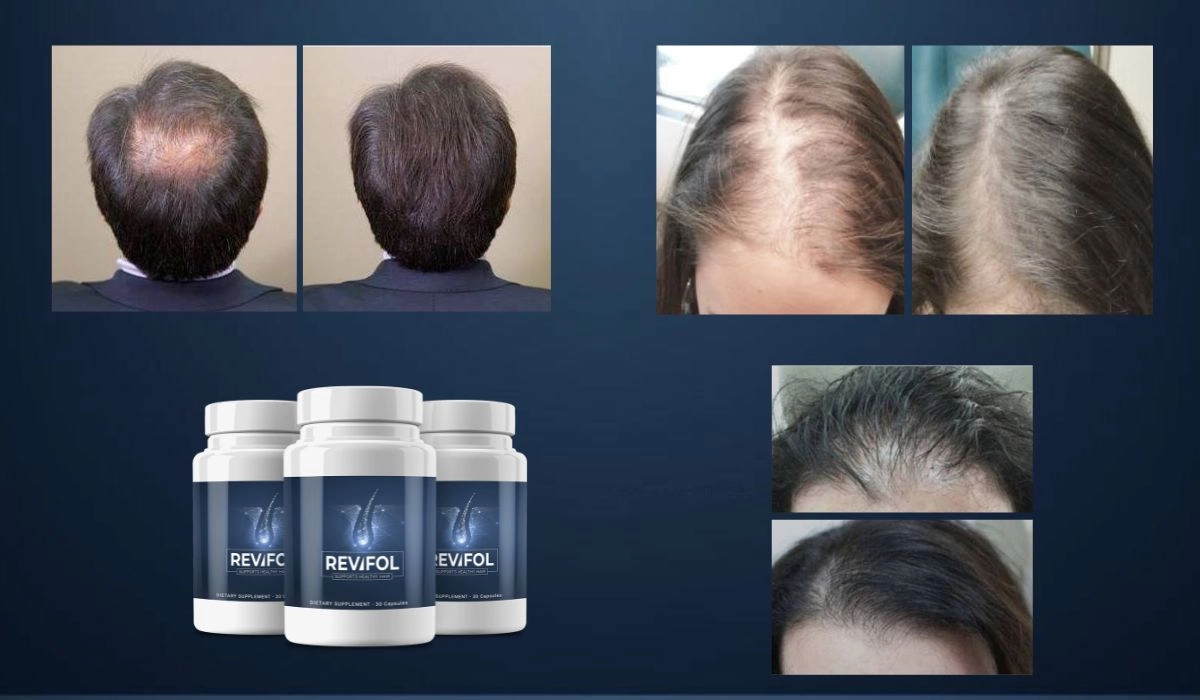 Revifol Before And After Results
