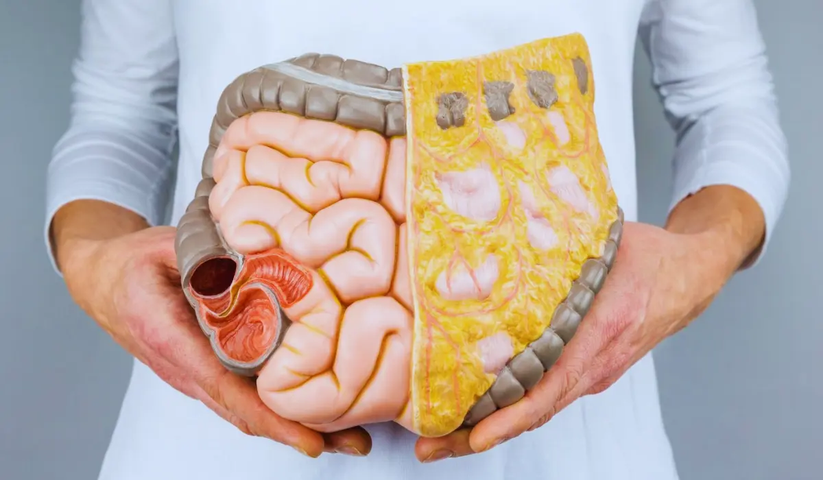 What Is Ulcerative Colitis