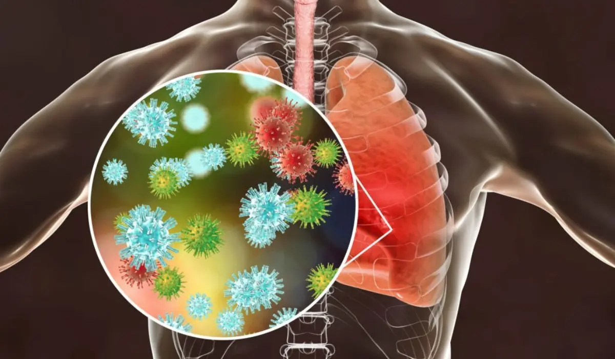 What Is Upper Respiratory Infection 
