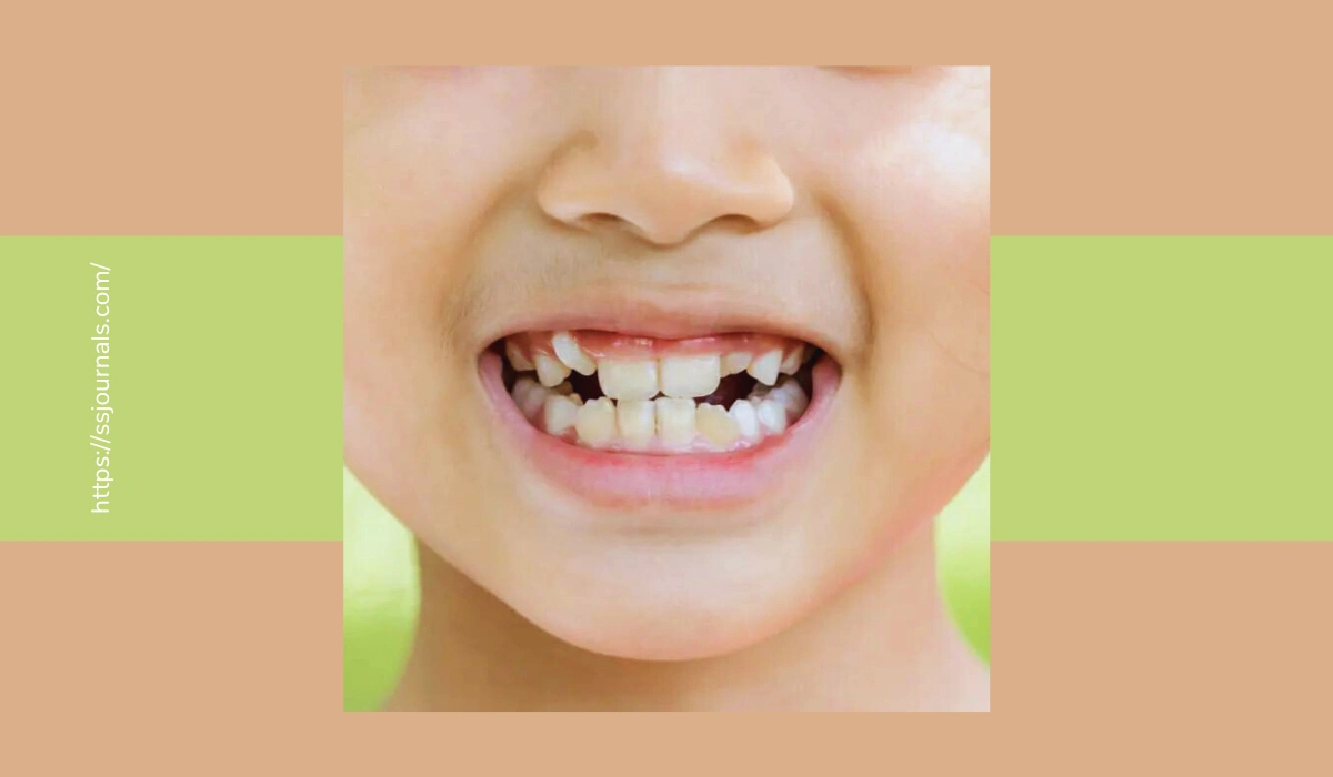 Malocclusion Of Teeth
