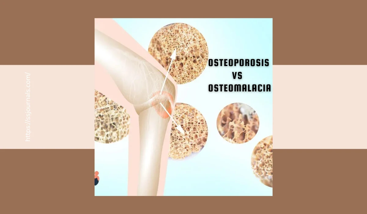 Osteoporosis vs Osteomalacia