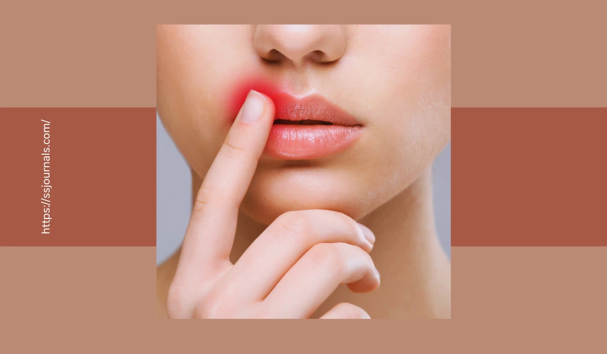 Reduce Swelling After Lip Filler
