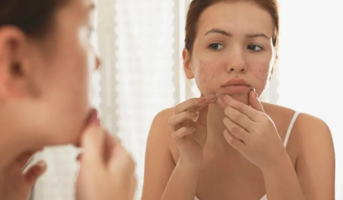 Lack Of Sleep Can Affect Your Skin