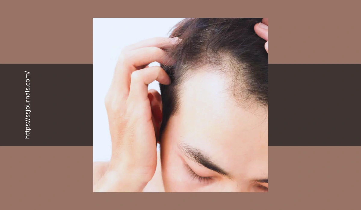 prevent Receding Hairline