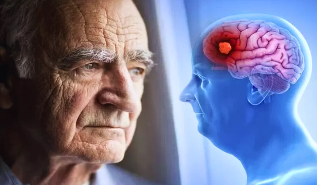 7 Stages of Lewy Body Dementia