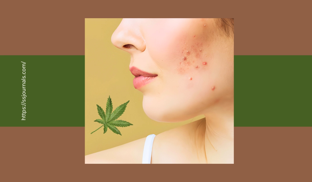 Does Smoking Weed Cause Acne