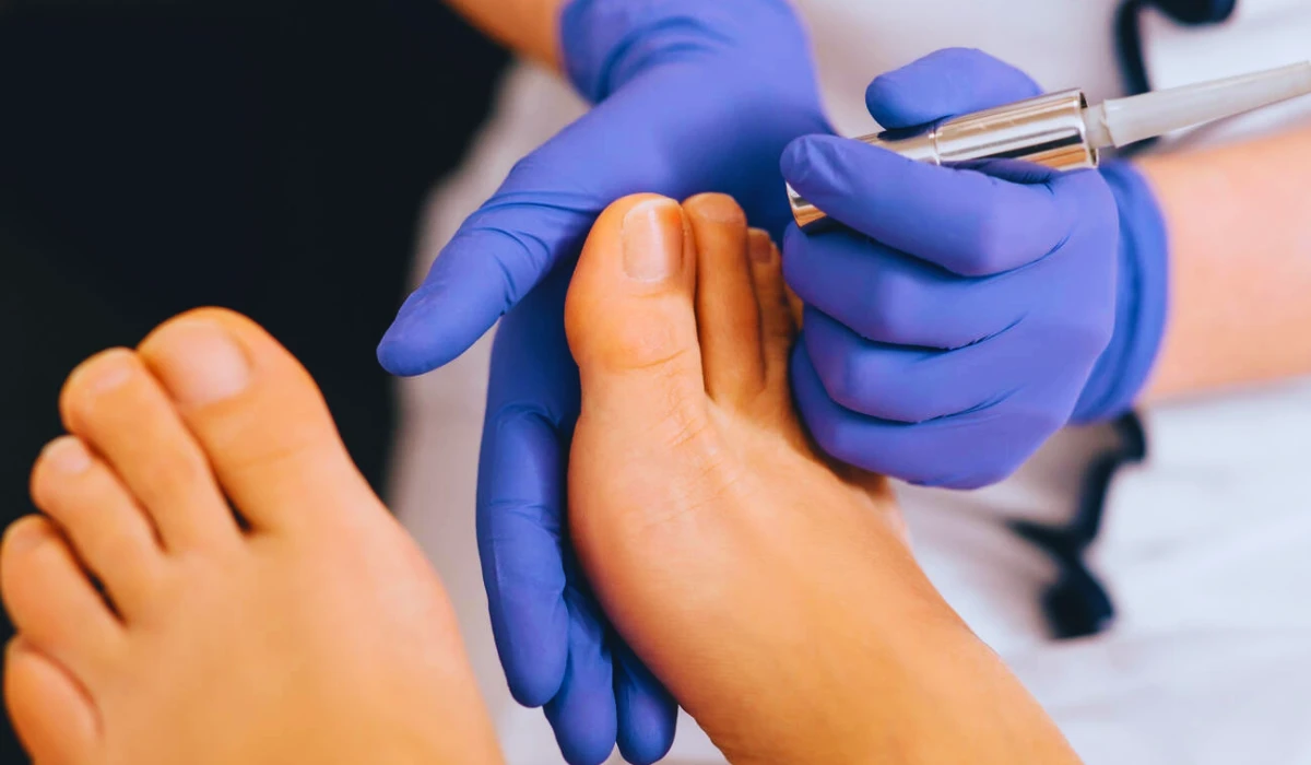 Laser Treatment For Toenail Fungus