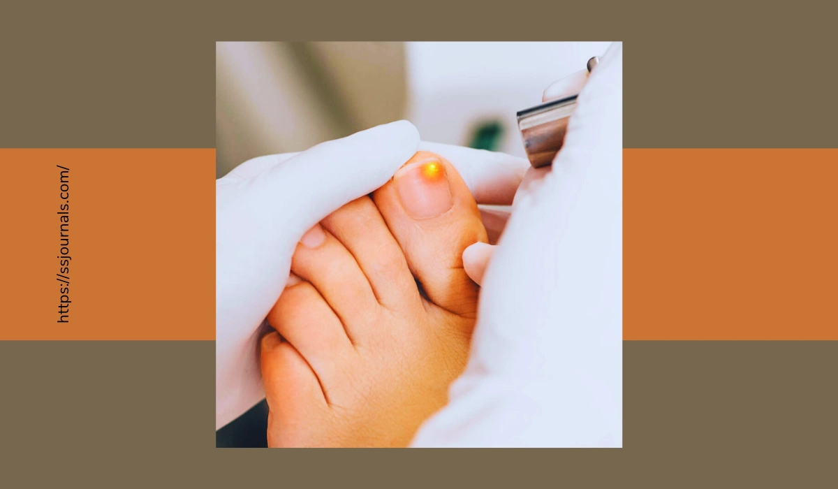 Pros And Cons Of Laser Treatment For Toenail Fungus All You Need To Know