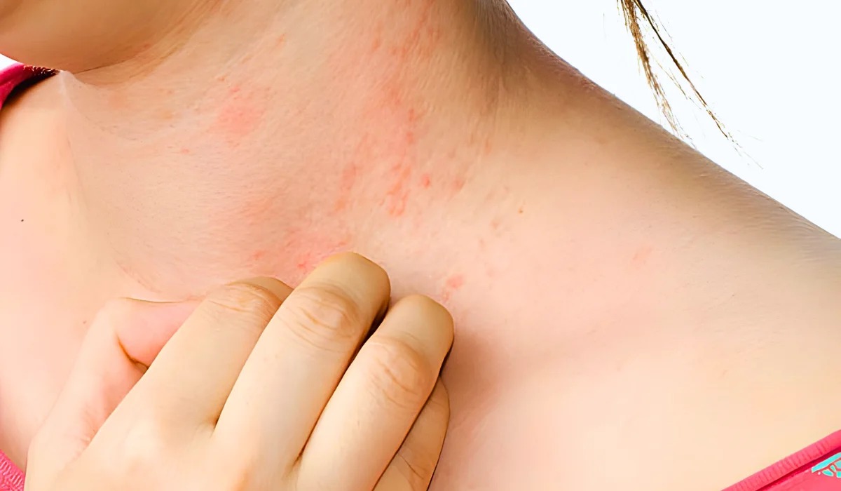 How to Apply Castor Oil for Eczema