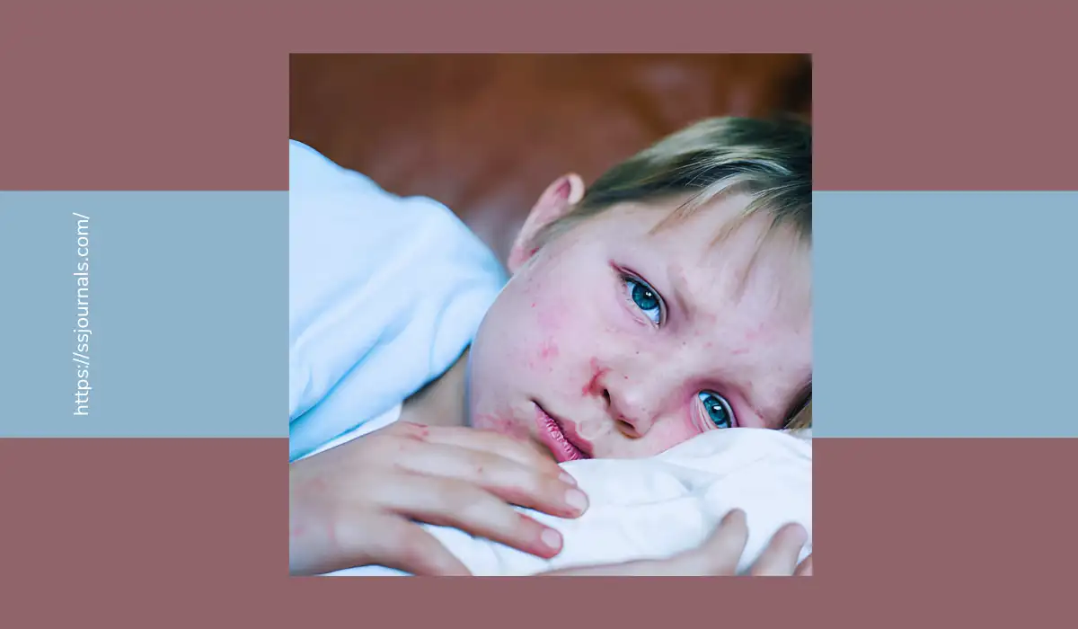 Symptoms Of Measles